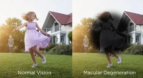 Common Retinal Conditions