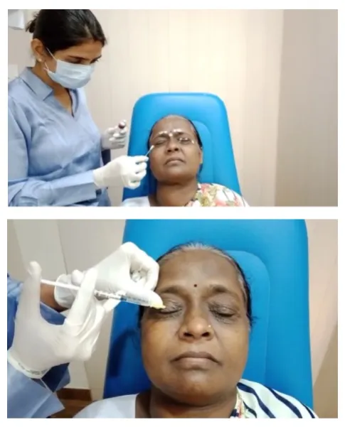 Common Oculoplasty & Orbital Conditions
